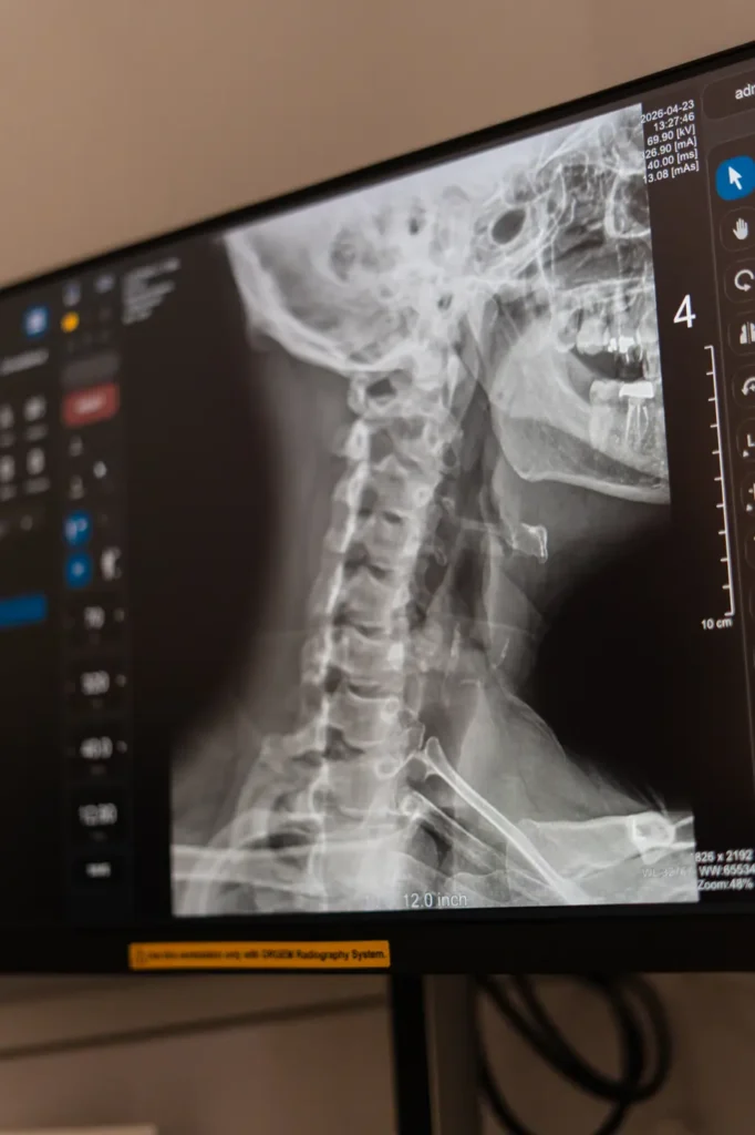 Cervical spine X-ray displayed on the FTG Ortho imaging workstation
