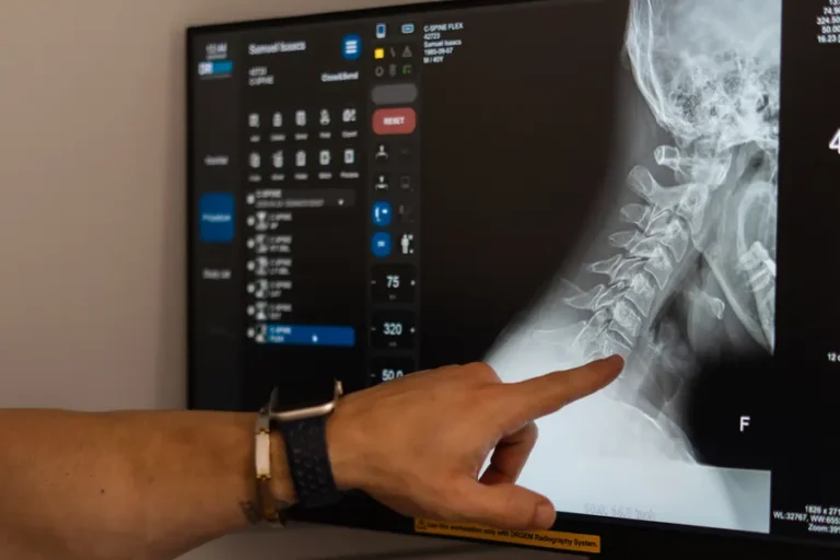 FTG Ortho clinician pointing to a cervical spine X-ray on screen